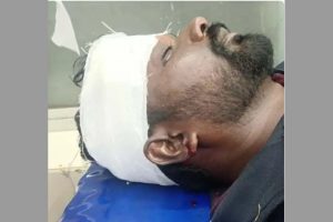 K’taka: BJP worker attacked for questioning Cong MLA on social media