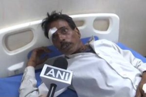 10 Amarnath Pilgrims Injured in Bus Accident While En Route to Vaishno Devi in J&K’s Kulgam