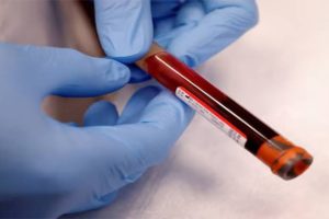 Russia Announces Colon Cancer Vaccine Ready for Use After Successful Trials